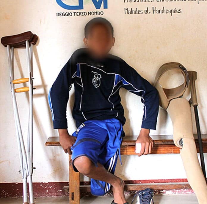 Image à la une de Violences envers les handicapés : 24,11% des enfants, victimes