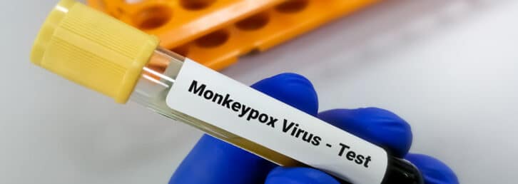 Image à la une de SANTE – L’OMS déclenche son plus haut niveau d’alerte mondiale face au virus Mpox ou la variole du singe