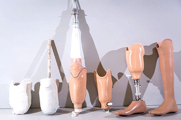 Image à la une de CHU Anosiala : Des prothèses orthopédiques gratuites en octobre