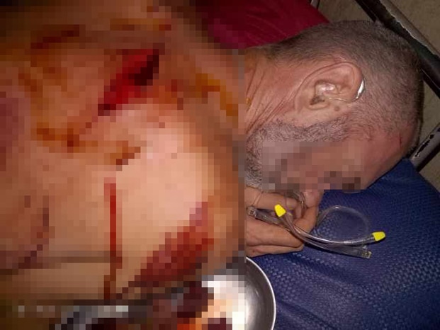 Image à la une de Sanglante attaque d’un étranger à Ambilobe  – Deux tireurs de pousse dans le filet