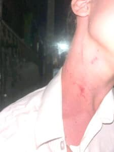 Image à la une de Ambatonakanga : Deux ressortissants français agressés dans une boîte de nuit