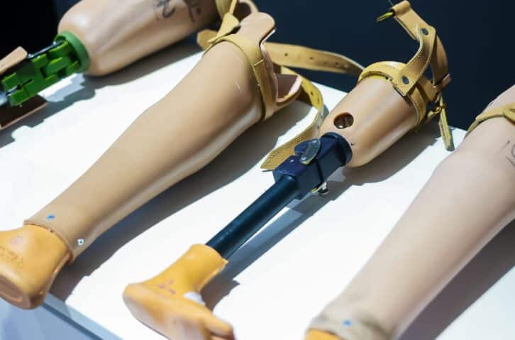 Image à la une de SOINS – Plus de 600 personnes à doter de prothèses orthopédique dans le cadre du Camp Jaipur Foot