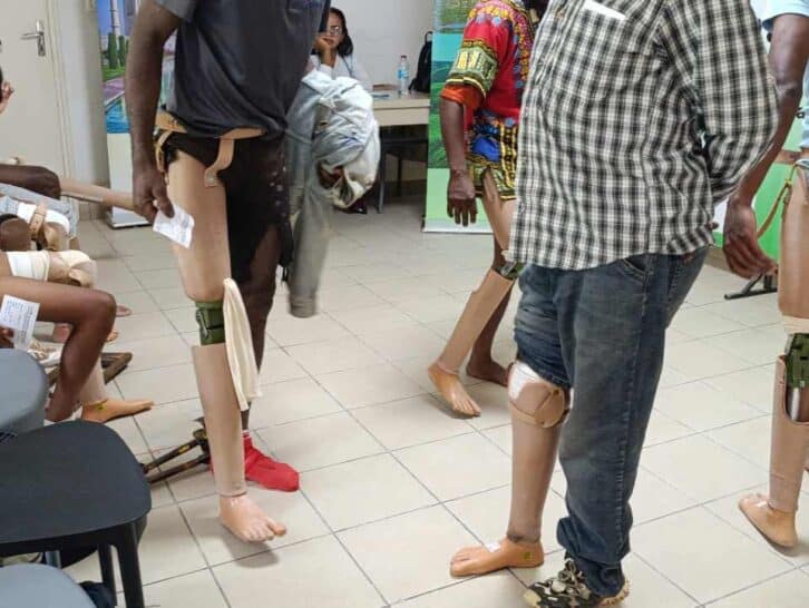 Image à la une de APPAREILLAGE ORTHOPÉDIQUE – La vie de centaines d’amputés se transforme