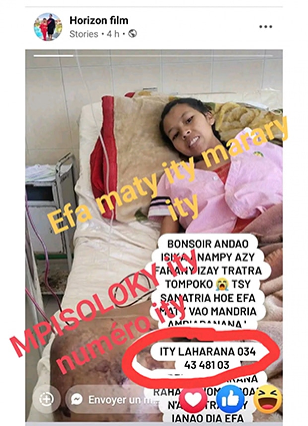 Image à la une de Compassion Madagascar – Victime d’arnaque sur Facebook