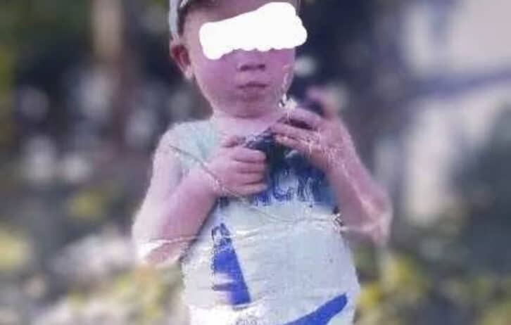 Image à la une de VOHIPENO – Un enfant albinos kidnappé dans son sommeil