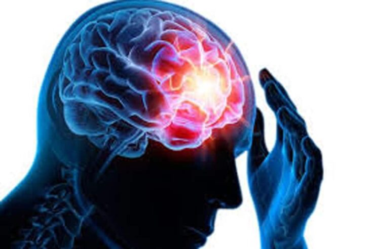 Image à la une de Epilepsie : Les idées reçues, encore tenaces