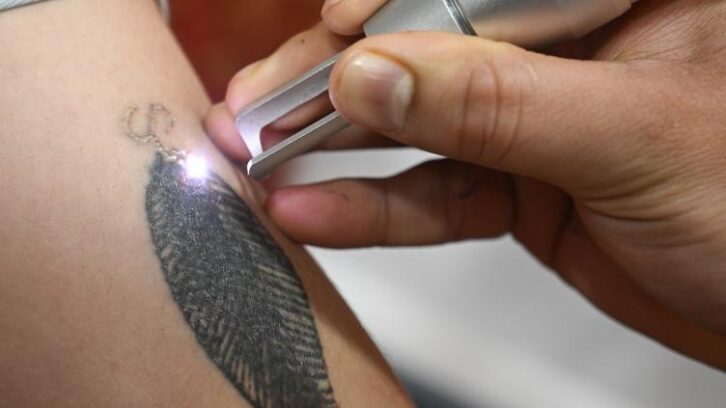 Image à la une de Au Cachemire indien, le nettoyage des tatouages politiques bat son plein