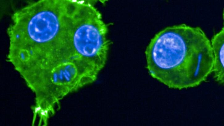 Image à la une de Peste, lèpre… Des chercheurs scrutent les microbes du passé